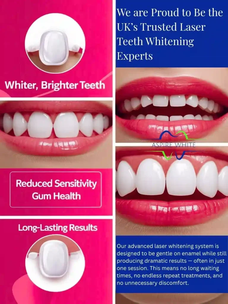 We are Proud to Be the UK’s Trusted Laser Teeth Whitening Experts Stratford upon Avon